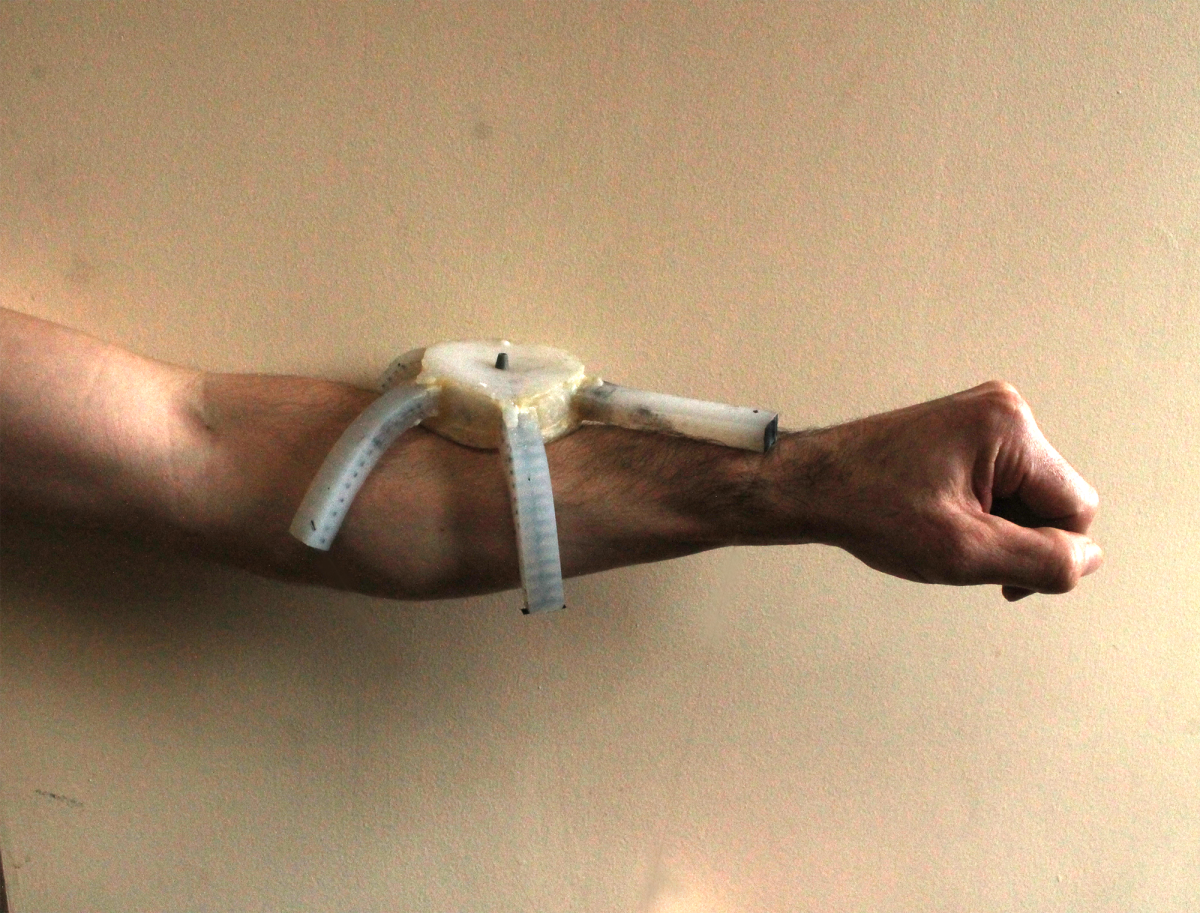When pressurised, it gripped the limb