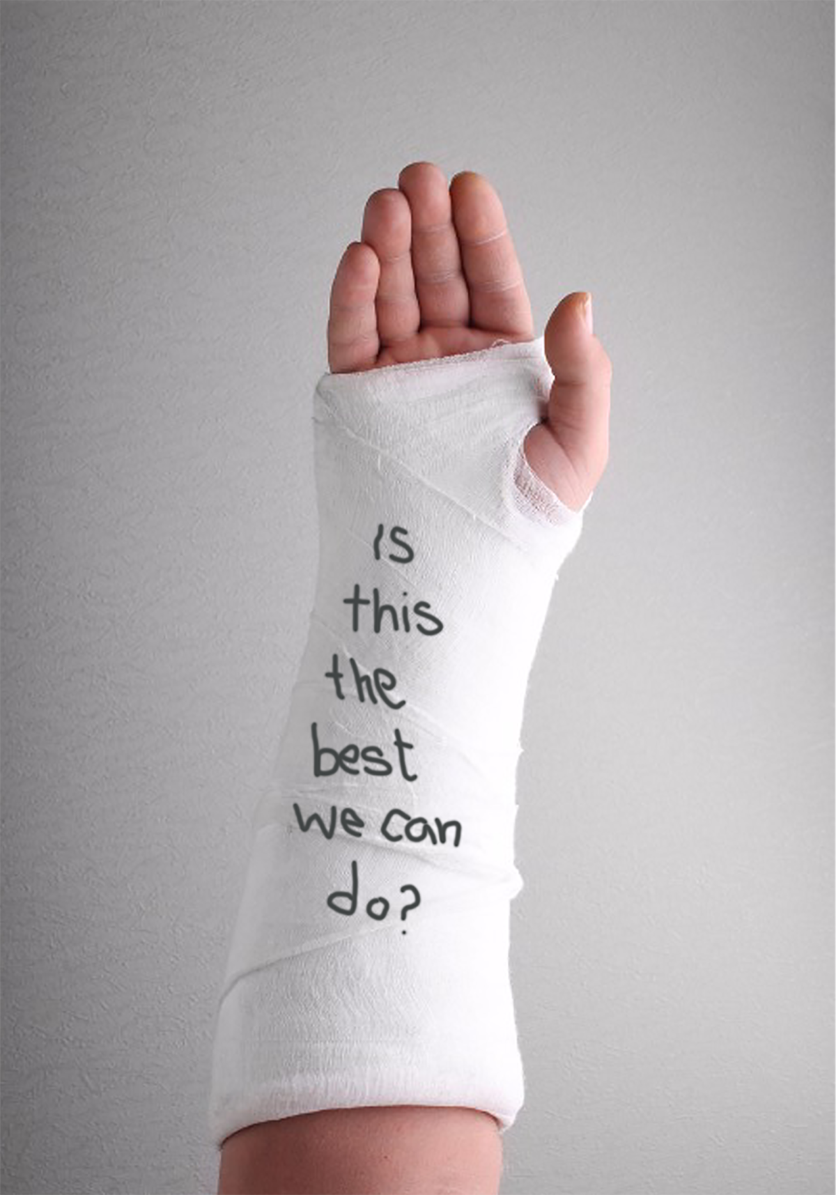 Traditional plaster casting is outdated technology