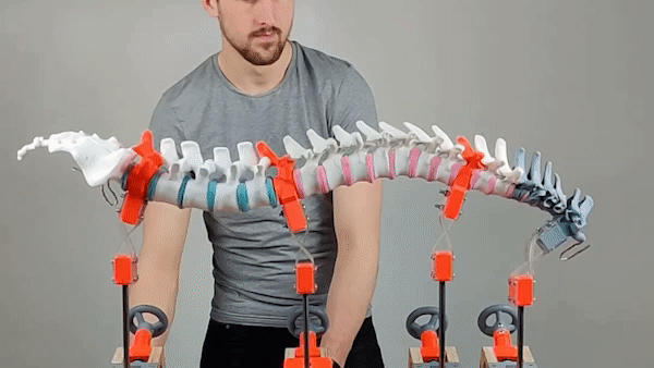 Example of the precise manipulation and augmentation of the spine possible with Re-Form