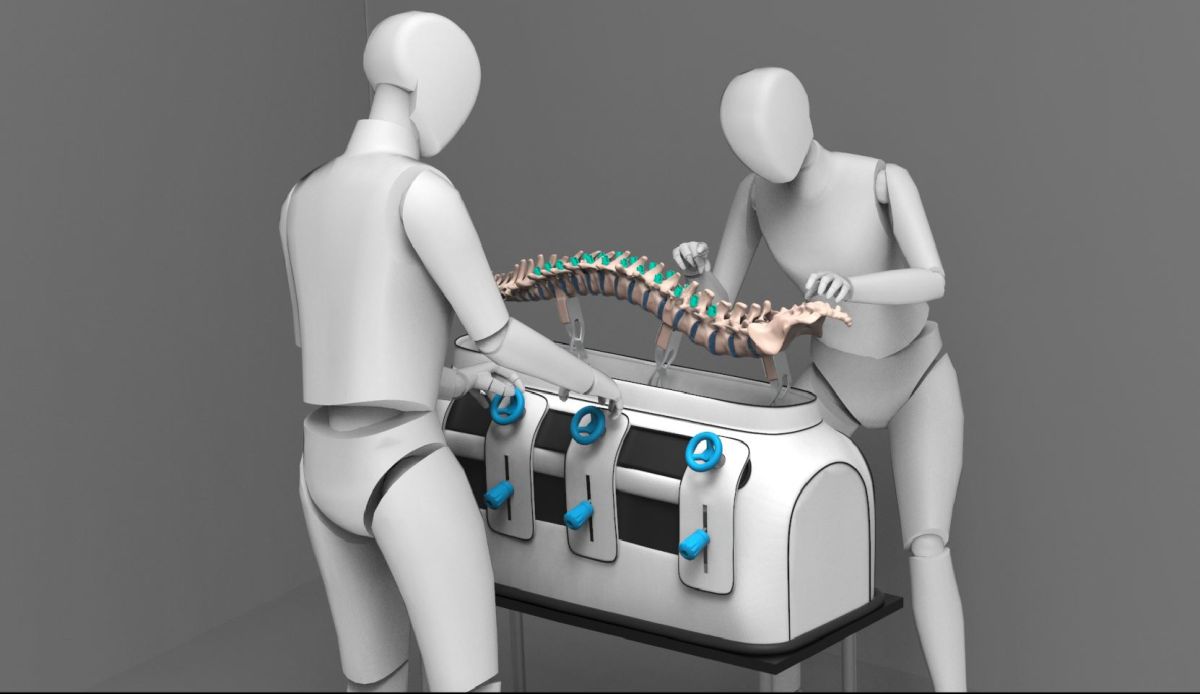 Use case scenario of surgeons creating a curvature on Re-Form
